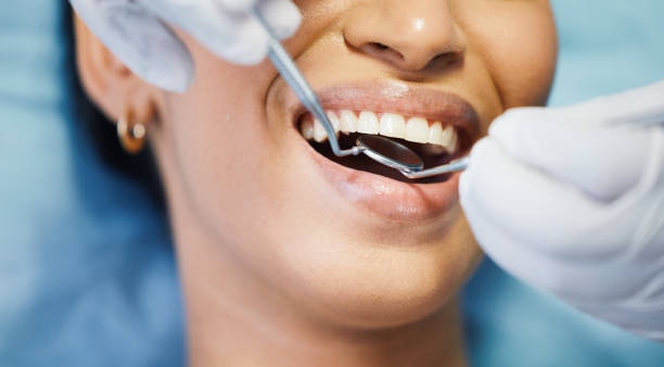 Best Cosmetic Emergency Dentistry in Upper Exeter, PA