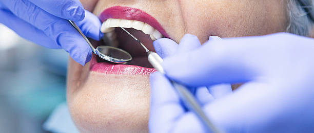 Best Emergency Root Canal Treatment in Upper Exeter, PA